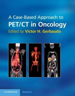 Cover Case-Based Approach to PET/CT in Oncology (eBook, PDF)