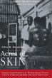 Acres of Skin (eBook, ePUB) - Bild 1
