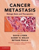 Cancer Metastasis (eBook, PDF)