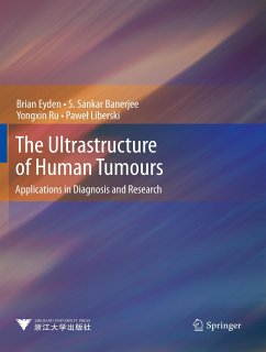 The Ultrastructure of Human Tumours - Eyden, Brian;Banerjee, S. Sankar;Ru, Yongxin