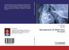 Management of Adult Class III Cases - Mahajan, Harsha;Vakil, Ketan;Vakil, Jeegar