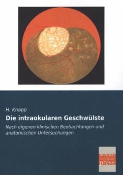 Die intraokularen Geschwülste - Knapp, H.