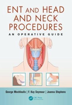 Ent and Head and Neck Procedures - Mochloulis, George; Seymour, F Kay; Stephens, Joanna