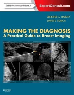 Making the Diagnosis: A Practical Guide to Breast Imaging - Harvey, Jennifer; March, David E