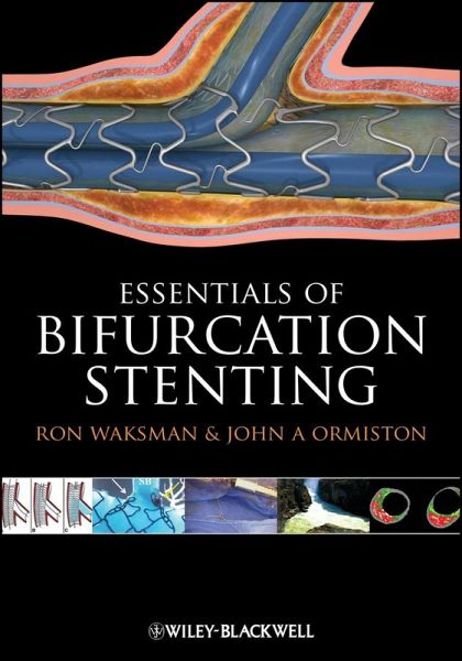 Bifurcation Stenting (eBook, ePUB) Bifurcation Stenting (eBook, ePUB)