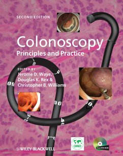 Colonoscopy (eBook, ePUB)