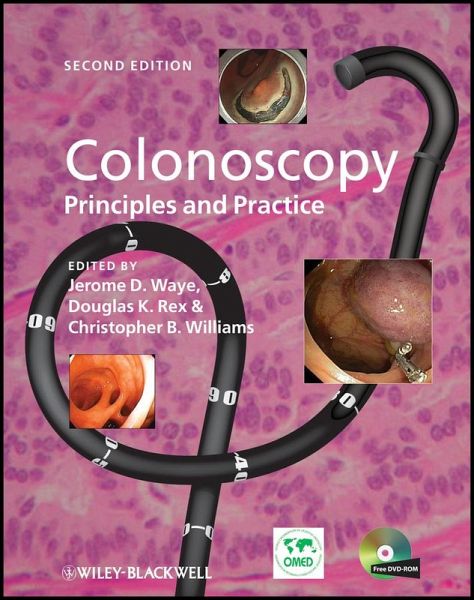 Colonoscopy (eBook, ePUB) Colonoscopy (eBook, ePUB)