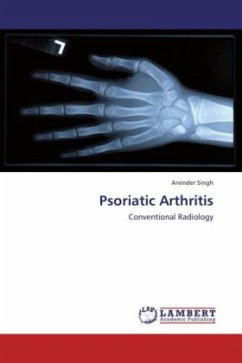 Psoriatic Arthritis - Singh, Arvinder