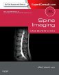 Spine Imaging: Case Review Series - Bild 1