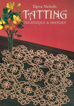 Tatting (eBook, ePUB) - Nicholls, Elgiva
