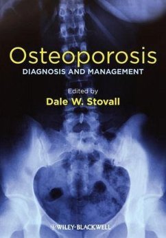 Cover Osteoporosis (eBook, PDF)
