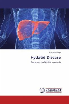 Hydatid Disease