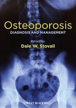 Osteoporosis (eBook, ePUB)