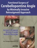 Functional Surgery of Cerebellopontine Angle by Minimally Invasive Retrosigmoid Approach Functional Surgery of Cerebellopontine Angle by Minimally Invasive Retrosigmoid Approach