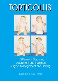 Cover Torticollis (eBook, PDF)