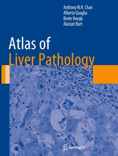 Atlas of Liver Pathology - Chan, Anthony W.H.;Quaglia, Alberto;Haugk, Beate