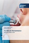 Full Mouth Rehablitation