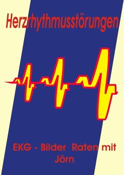 Herzrhythmusstörungen (eBook, ePUB)