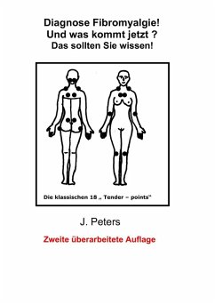 Diagnose Fibromyalgie! Und was kommt jetzt? (eBook, ePUB) - Peters, Joachim