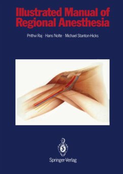 Illustrated Manual of Regional Anesthesia - Raj, P. Prithri;Nolte, Hans;Stanton-Hicks, Michael