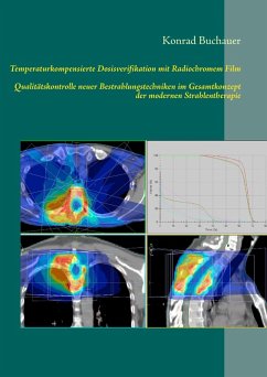 Temperaturkompensierte Dosisverifikation mit Radiochromem Film (eBook, ePUB)