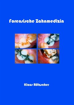 Forensische Zahnmedizin (eBook, ePUB)