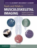 Pearls and Pitfalls in Musculoskeletal Imaging (eBook, PDF)