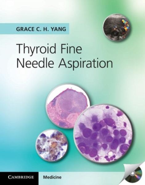 Thyroid Fine Needle Aspiration (eBook, PDF)