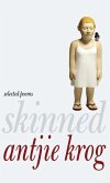 Skinned (eBook, ePUB)