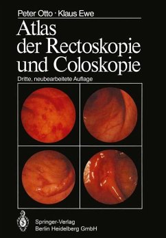Atlas der Rectoskopie und Coloskopie - Otto, P.;Ewe, Klaus