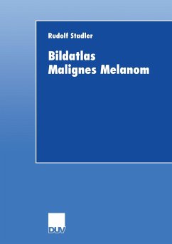 Bildatlas Malignes Melanom - Stadler, Rudolf