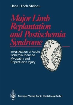 Major Limb Replantation and Postischemia Syndrome - Steinau, Hans-Ulrich