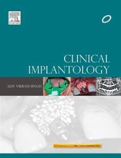 Clinical Implantology - Singh, Ajay Vikram