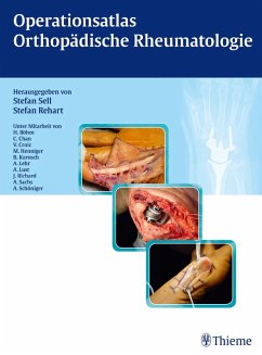 Operationsatlas Orthopädische Rheumatologie (eBook, PDF)