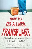 How to do a liver transplant