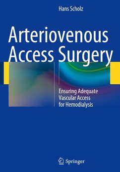Arteriovenous Access Surgery - Scholz, Hans