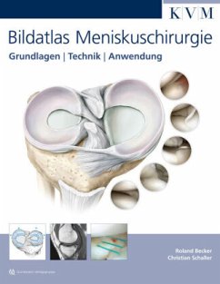 Bildatlas Meniskuschirurgie - Becker, Roland;Schaller, Christian