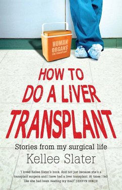 Cover How to Do a Liver Transplant (eBook, ePUB)