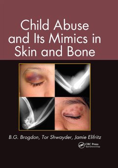 Child Abuse and its Mimics in Skin and Bone (eBook, PDF) - Brogdon, B. G.; Shwayder, Tor; Elifritz, Jamie