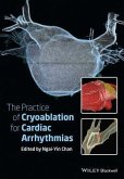 The Practice of Catheter Cryoablation for Cardiac Arrhythmias (eBook, ePUB)