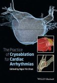 The Practice of Catheter Cryoablation for Cardiac Arrhythmias (eBook, PDF)
