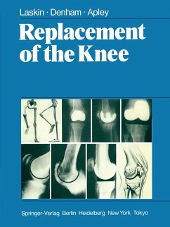 Replacement of the Knee - Laskin, R. S.;Denham, R. A.;Apley, A. G.