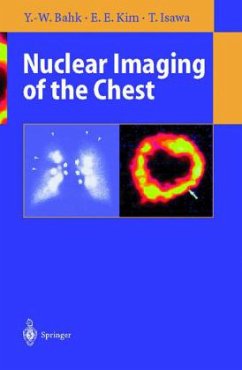 Nuclear Imaging of the Chest - Bahk, Yong-Whee;Kim, E.Edmund;Isawa, Toyoharu