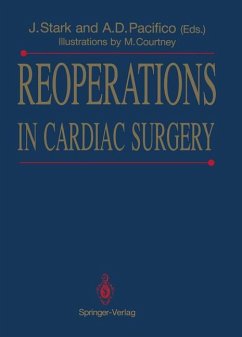 Reoperations in Cardiac Surgery