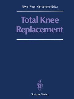 Total Knee Replacement