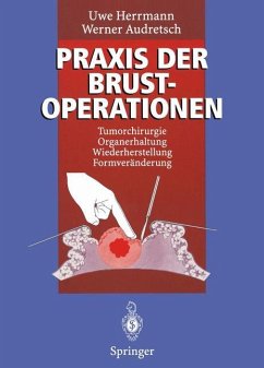 Praxis der Brustoperationen - Herrmann, Uwe;Audretsch, Werner