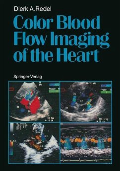 Color Blood Flow Imaging of the Heart - Redel, Dierk A.