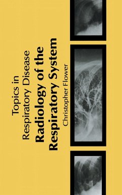 Radiology of the Respiratory System - Flower, C.D.R