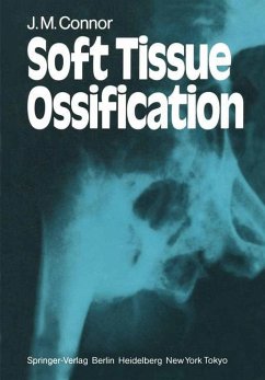 Soft Tissue Ossification - Connor, J. M.