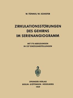 Zirkulationsstörungen des Gehirns im Serienangiogramm - Tönnis, W.;Schiefer, W.